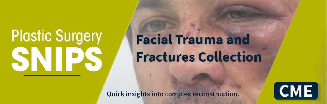 Facial Trauma and Fractures Collection | SNIPS Image