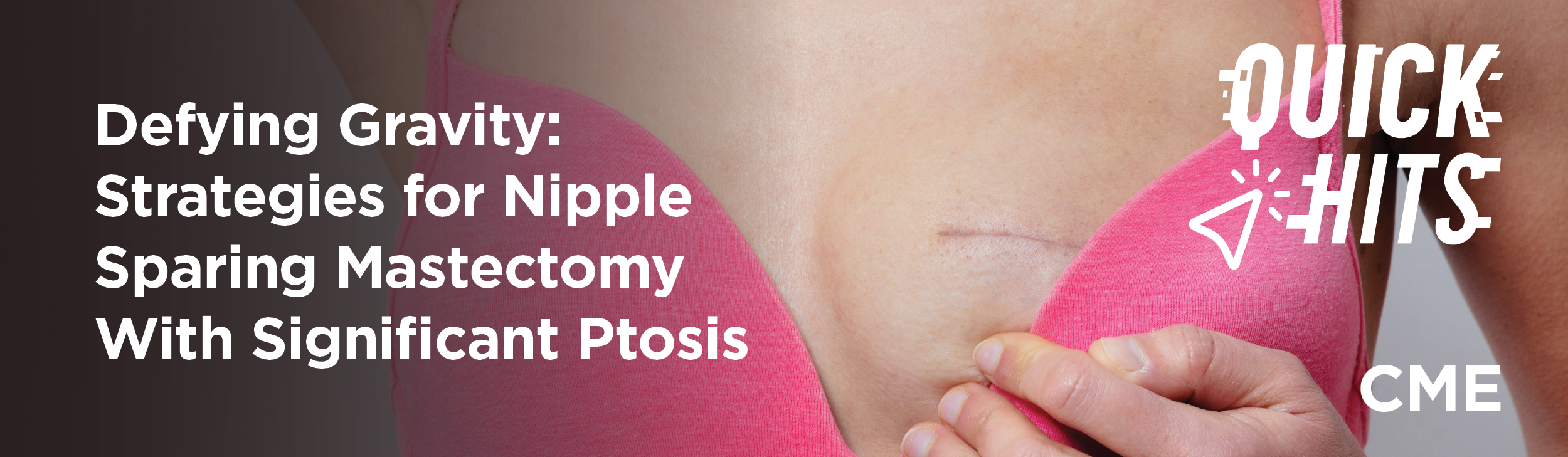 Defying Gravity: Strategies for Nipple Sparing Mastectomy With Significant Ptosis | Quick Hits!