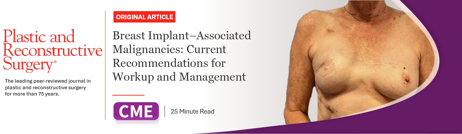 Breast Implant–Associated Malignancies: Current Recommendations for Workup and Management | Journal CME Image