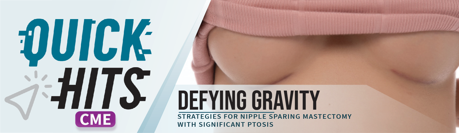 Defying Gravity: Strategies for Nipple Sparing Mastectomy With Significant Ptosis | Quick Hits! Image