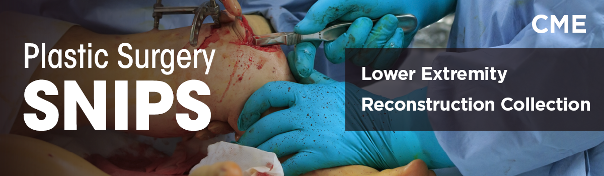 Lower Extremity Reconstruction Collection | SNIPS Image